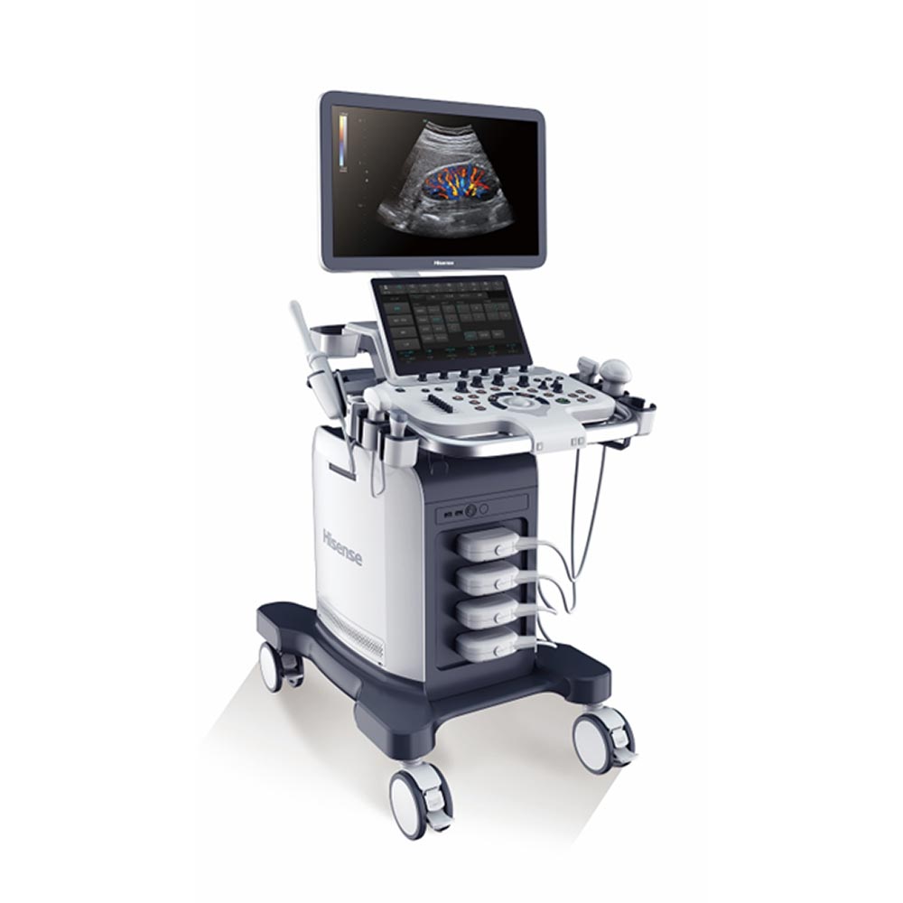 Sisteme-de-ultrasonografiere-HISENSE-HD60-series-2 Sisteme-de-ultrasonografiere-HISENSE-HD60-series-2